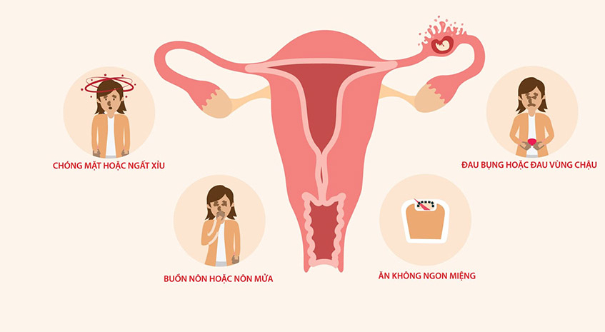mang thai ngoài tử cung là gì? liệu có gây nguy hiểm cho thai nhi và mẹ bầu